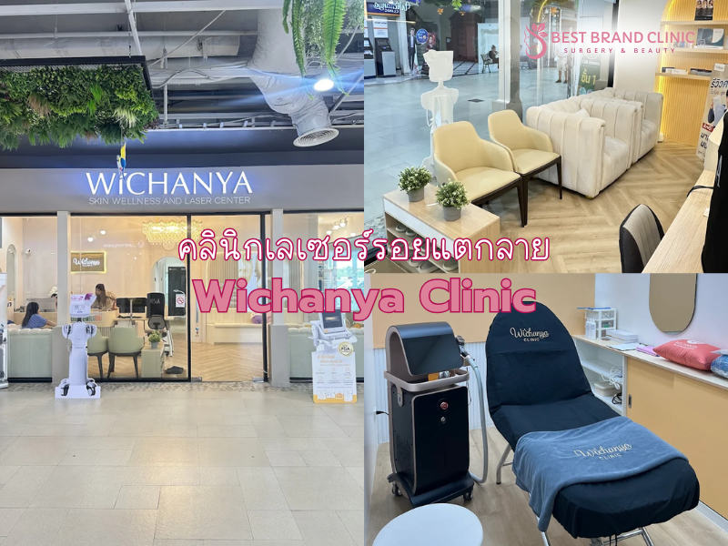 เลเซอร์รอยแตกลาย ที่ไหนดี Wichanya Clinic