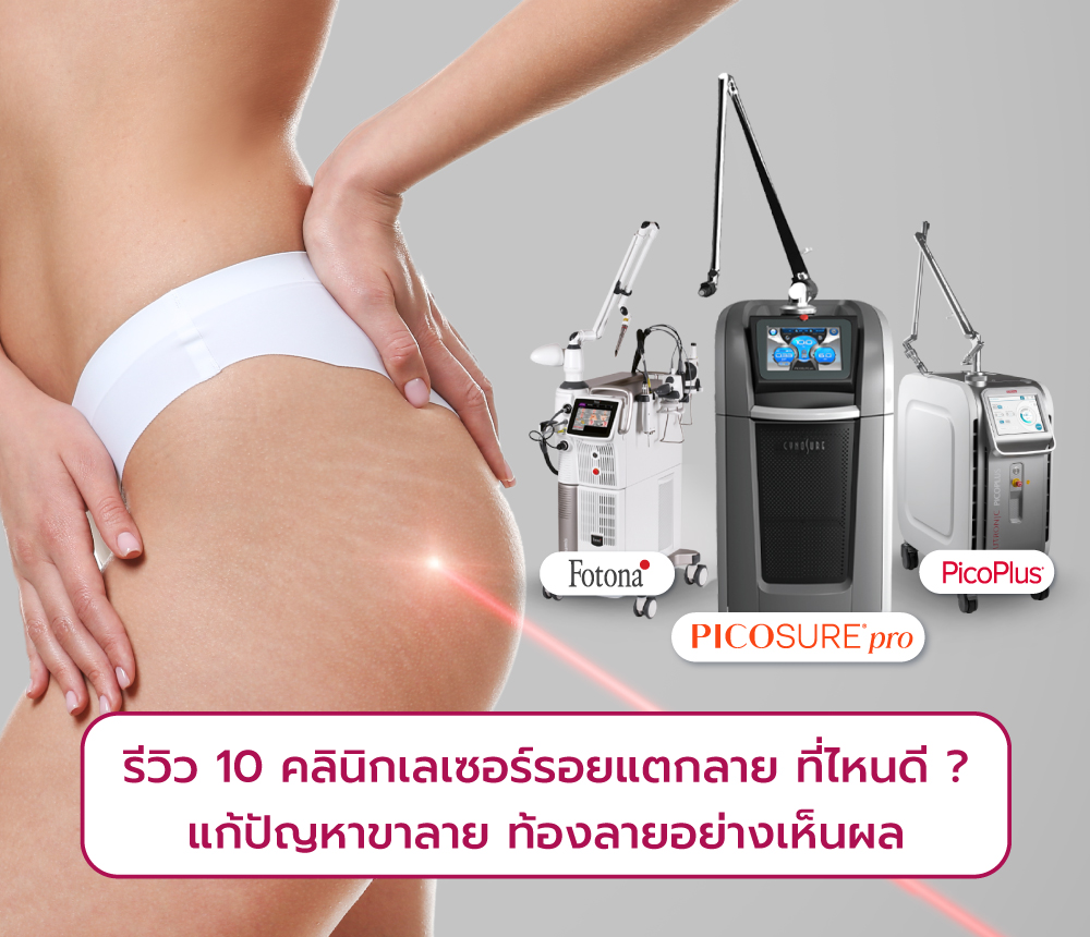 เลเซอร์รอยแตกลาย ที่ไหนดี