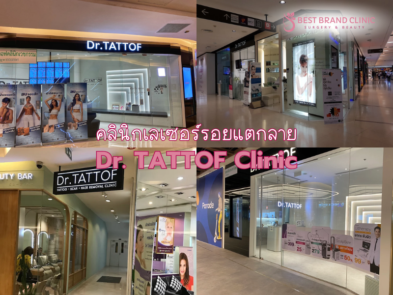 เลเซอร์ลดรอยแตกลาย ที่ไหนดี Dr. TATTOF Clinic