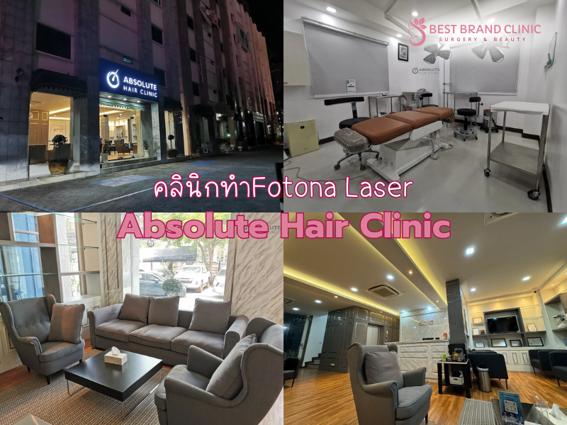 Fotona ที่ไหนดี รักษาผมร่วง Absolute Hair Clinic