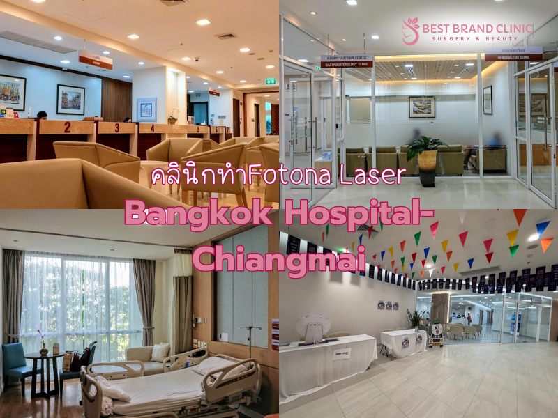 Fotona ที่ไหนดี เห็นผล Bangkok Hospital-Chiangmai