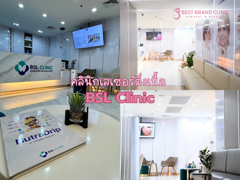 คลินิกเลเซอร์ติ่งเนื้อ ที่ไหนดี ที่ BSL Clinic
