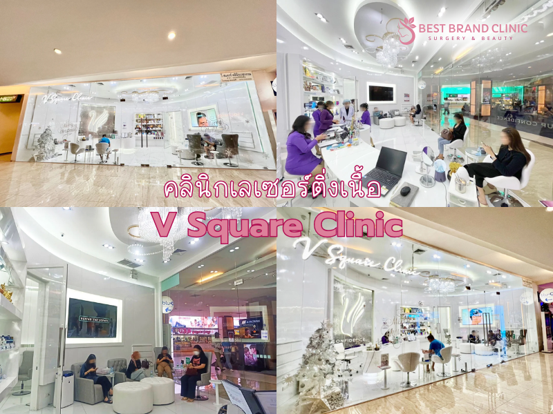 คลินิกเลเซอร์ติ่งเนื้อ ที่ไหนดี ที่ V Square Clinic