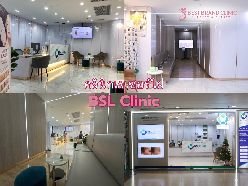 เลเซอร์กำจัดไฝ ที่ไหนดี BSL Clinic