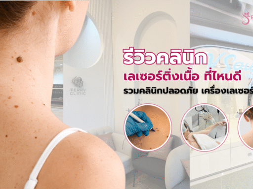 เลเซอร์ติ่งเนื้อ ที่ไหนดี