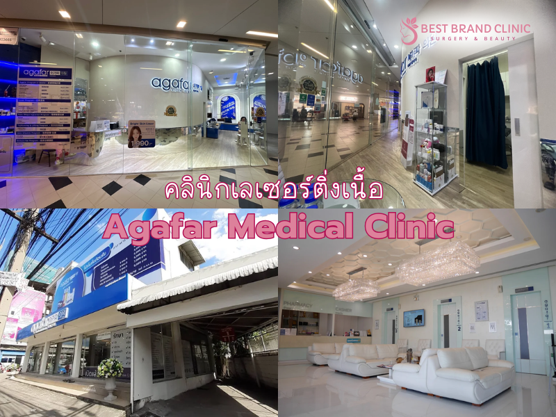 เลเซอร์ติ่งเนื้อ ที่ไหนดี Agafar Medical Clinic