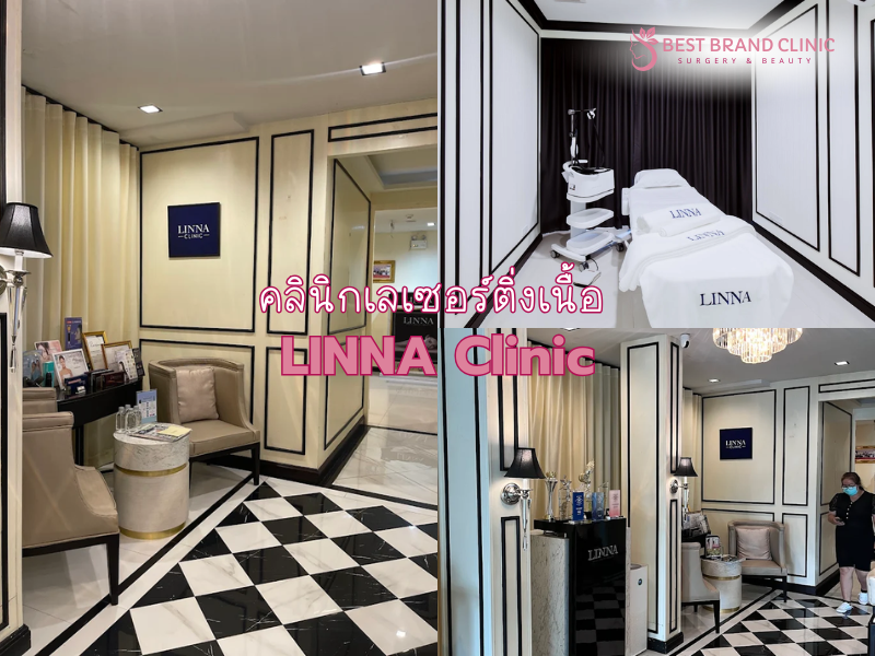 เลเซอร์ติ่งเนื้อ ที่ไหนดี LINNA Clinic