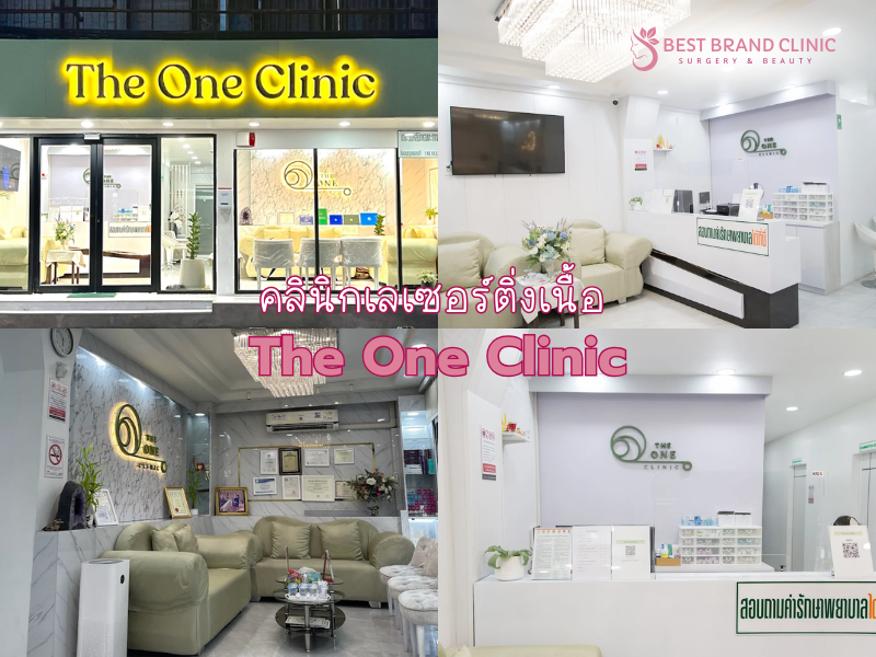 เลเซอร์ติ่งเนื้อ ที่ไหนดี The One Clinic