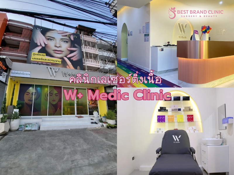 เลเซอร์ติ่งเนื้อ ที่ไหนดี W+ Medic Clinic