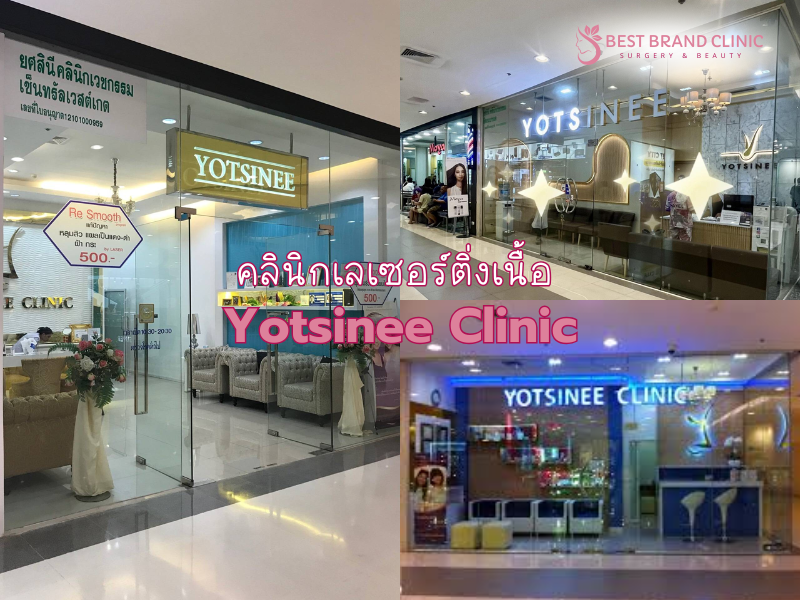 เลเซอร์ติ่งเนื้อ ที่ไหนดี Yotsinee Clinic