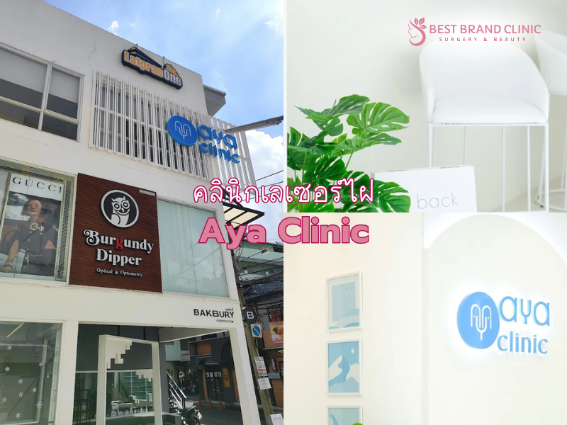 เลเซอร์ไฝ ขี้แมลงวัน เลือกที่ไหนดี Aya Clinic