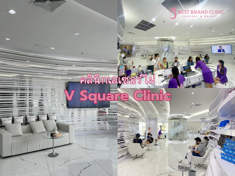 เลเซอร์ไฝ ที่ไหนดี V Square Clinic