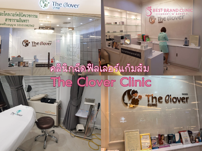 ฉีดฟิลเลอร์แก้มส้ม ที่ไหนดี The Clover Clinic