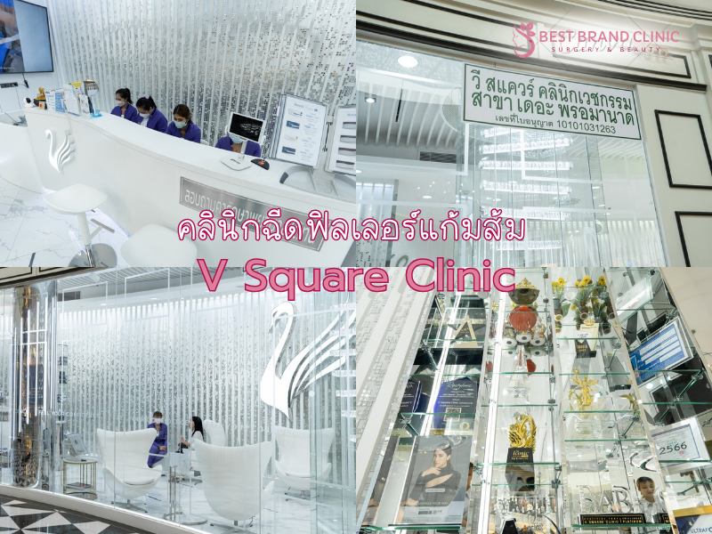 ฉีดฟิลเลอร์แก้มส้ม ที่ไหนดี V Square Clinic
