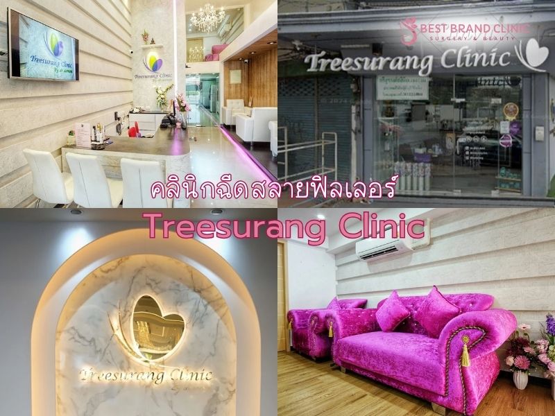 ฉีดสลายฟิลเลอร์ คลินิกไหนดี Treesurang Clinic