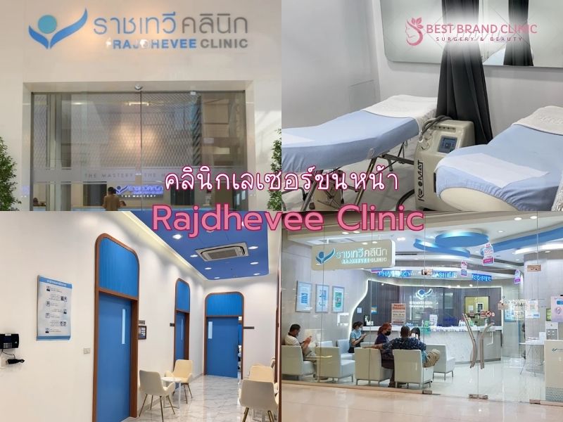 เซอร์ขนหน้า ที่ไหนดี Rajdhevee Clinic