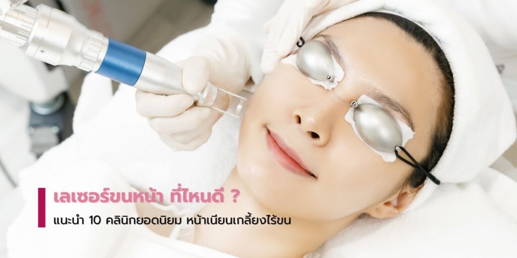 เลเซอร์ขนหน้า ที่ไหนดี