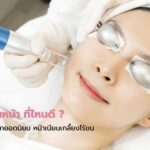 เลเซอร์ขนหน้า ที่ไหนดี