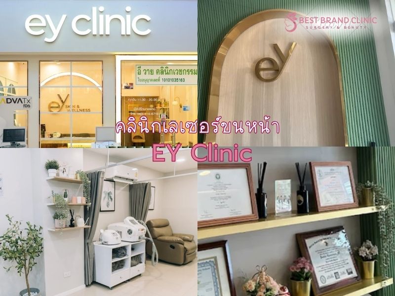 เลเซอร์ขนหน้า ที่ไหนดี EY Clinic