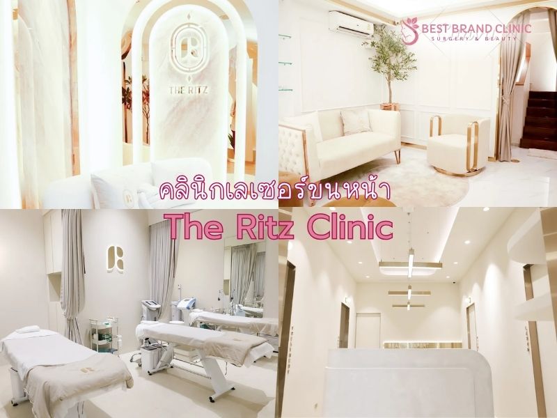 เลเซอร์ขนหน้า ที่ไหนดี The Ritz Clinic