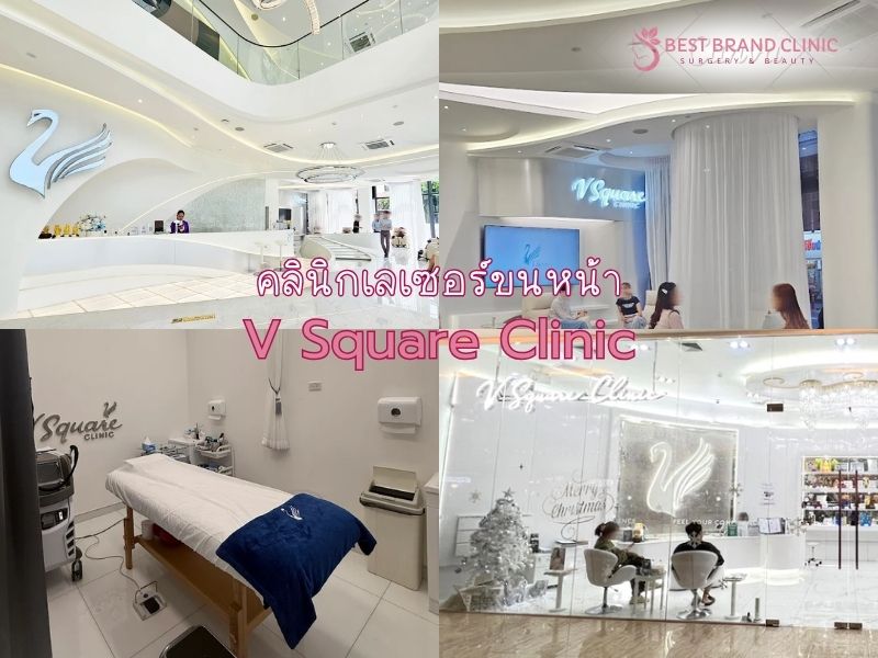 เลเซอร์ขนหน้า ที่ไหนดี V Square Clinic
