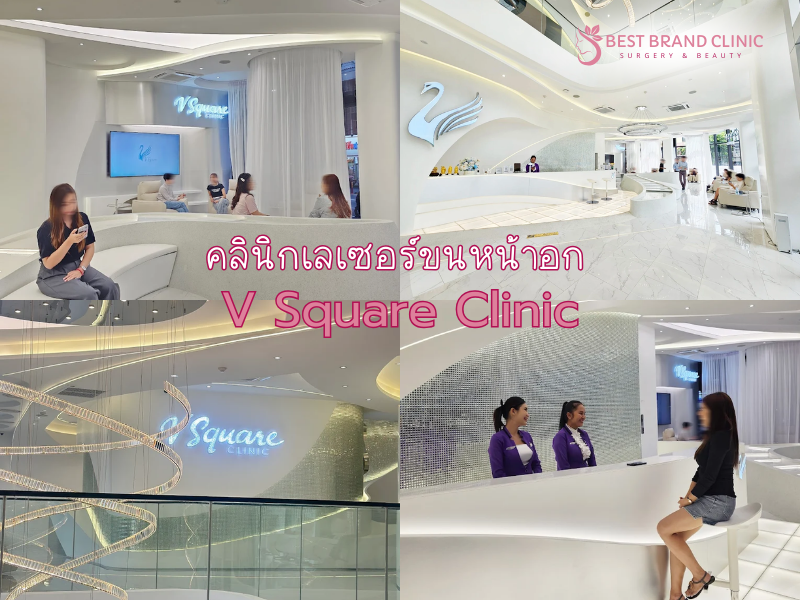 เลเซอร์ขนหน้าอก ที่ไหนดี V Square Clinic
