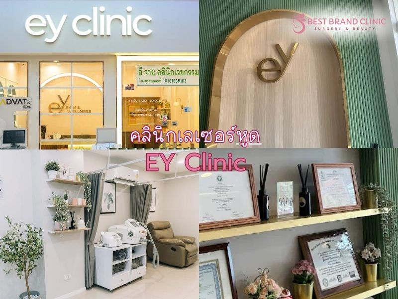 เลเซอร์หูด ที่ไหนดี EY Clinic