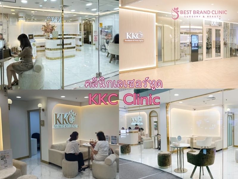 เลเซอร์หูด ที่ไหนดี KKC Clinic