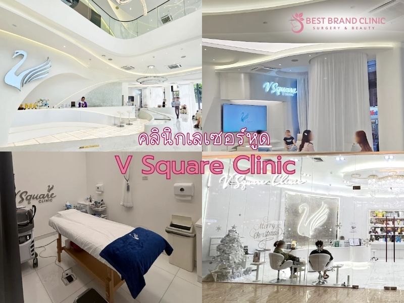 เลเซอร์หูด ที่ไหนดี V Square Clinic