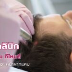 เลเซอร์ไรผม ที่ไหนดี