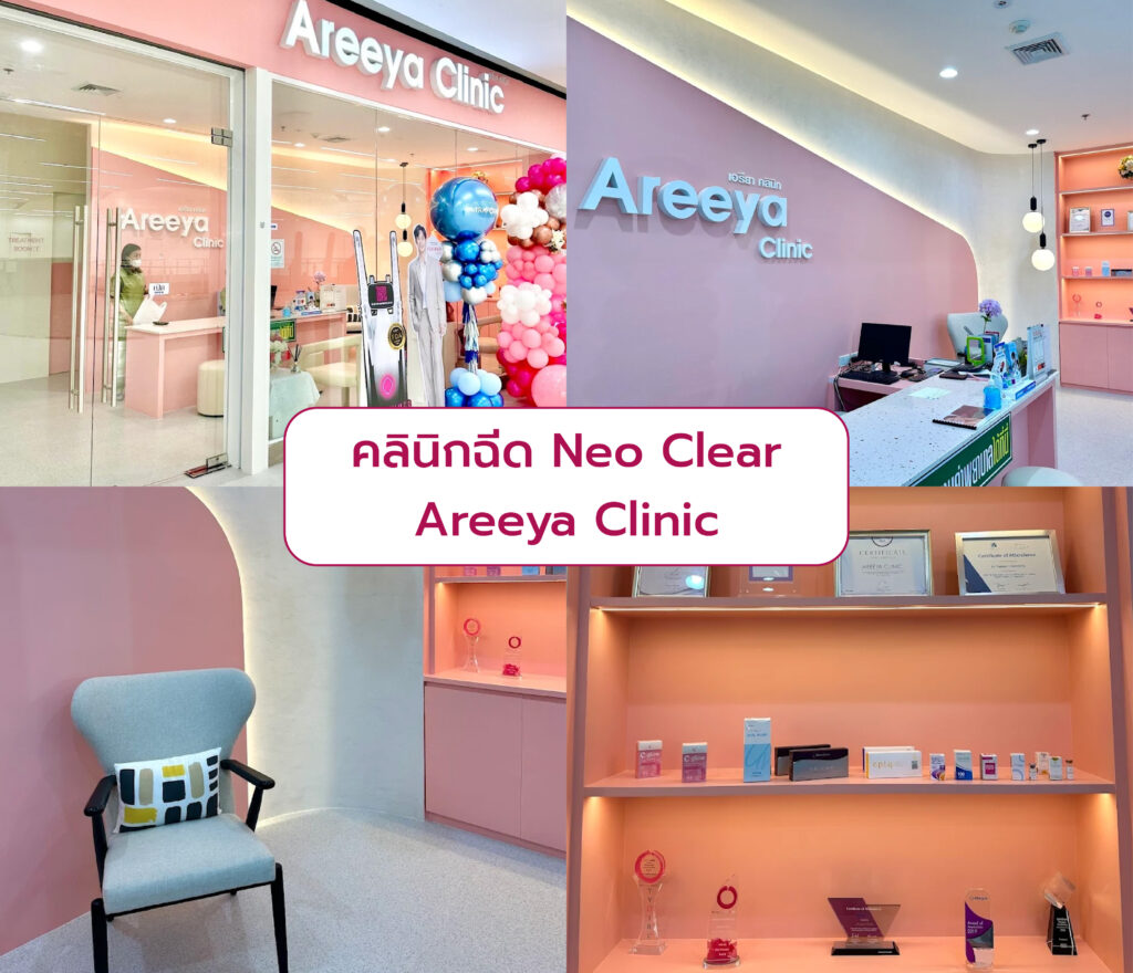 Neo Clear ที่ไหนดี Areeya Clinic
