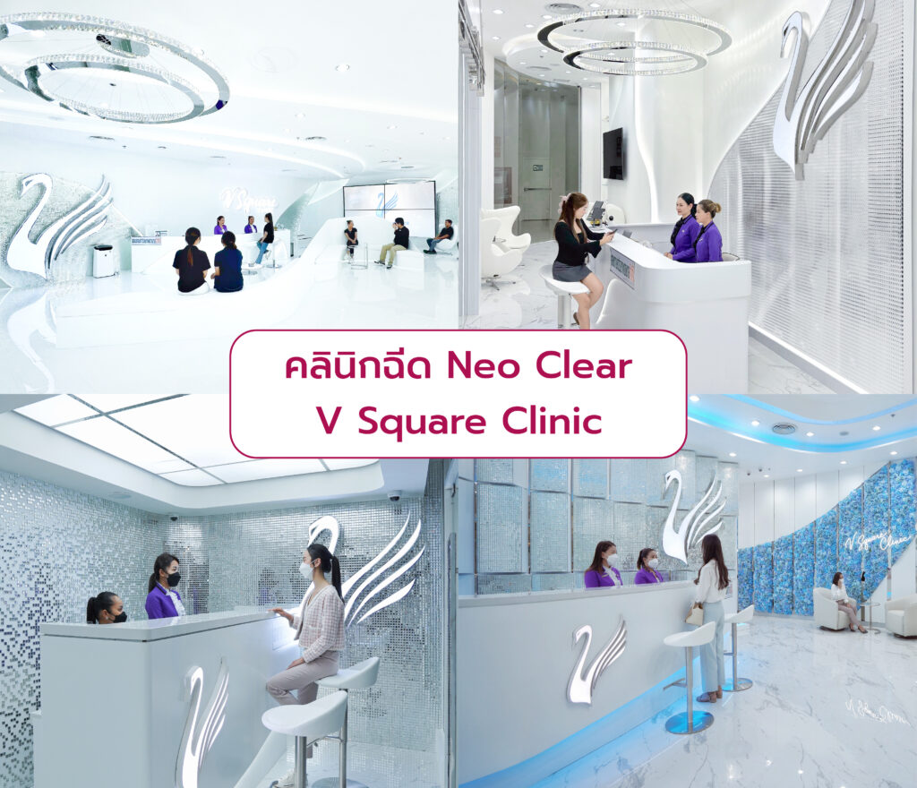 Neo Clear ที่ไหนดี V Square Clinic