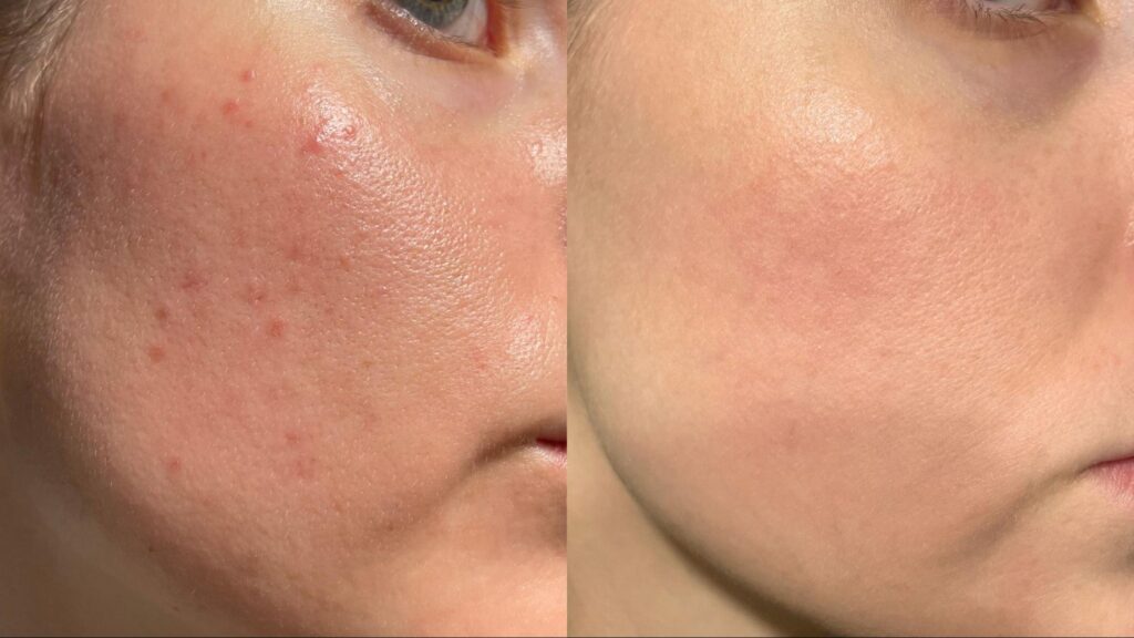 Neo Derm ช่วยเรื่องอะไรได้บ้าง