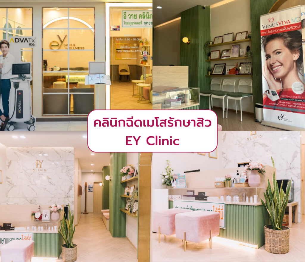 เมโสรักษาสิว ที่ไหนดี EY Clinic
