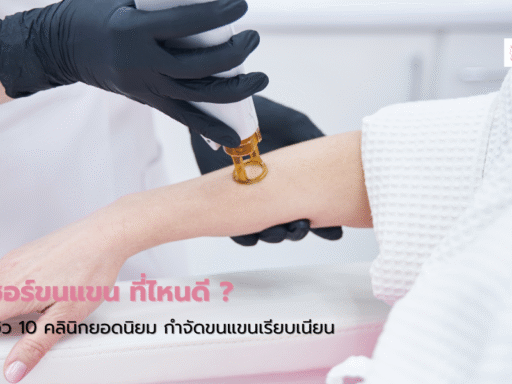 เลเซอร์ขนแขน ที่ไหนดี