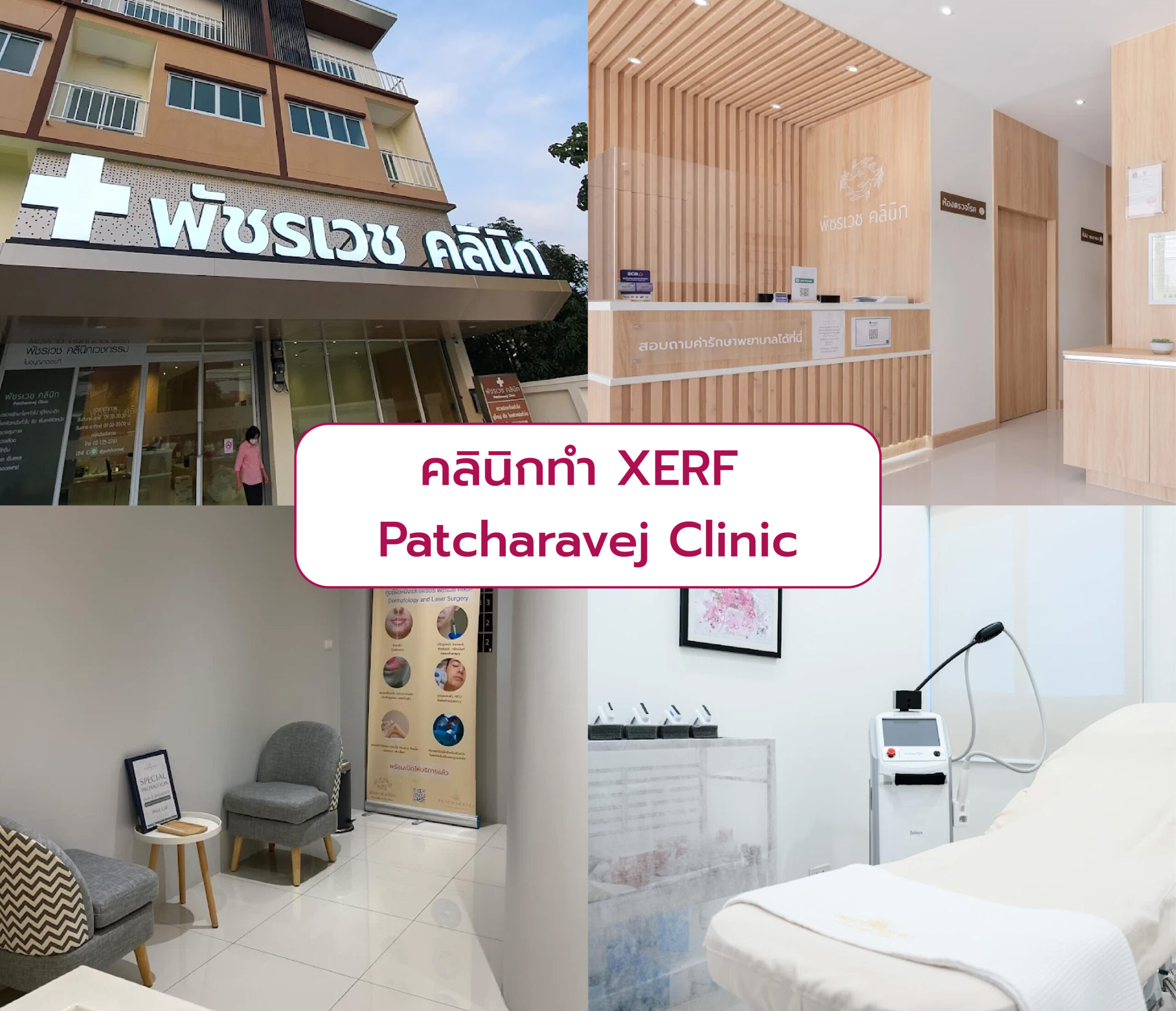 ทำ XERF ที่ไหนดี Patcharavej Clinic