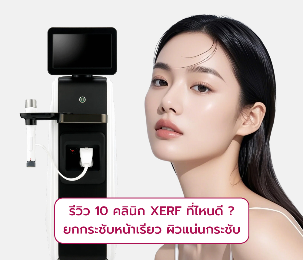 รีวิว10คลินิก-XERF-ที่ไหนดี