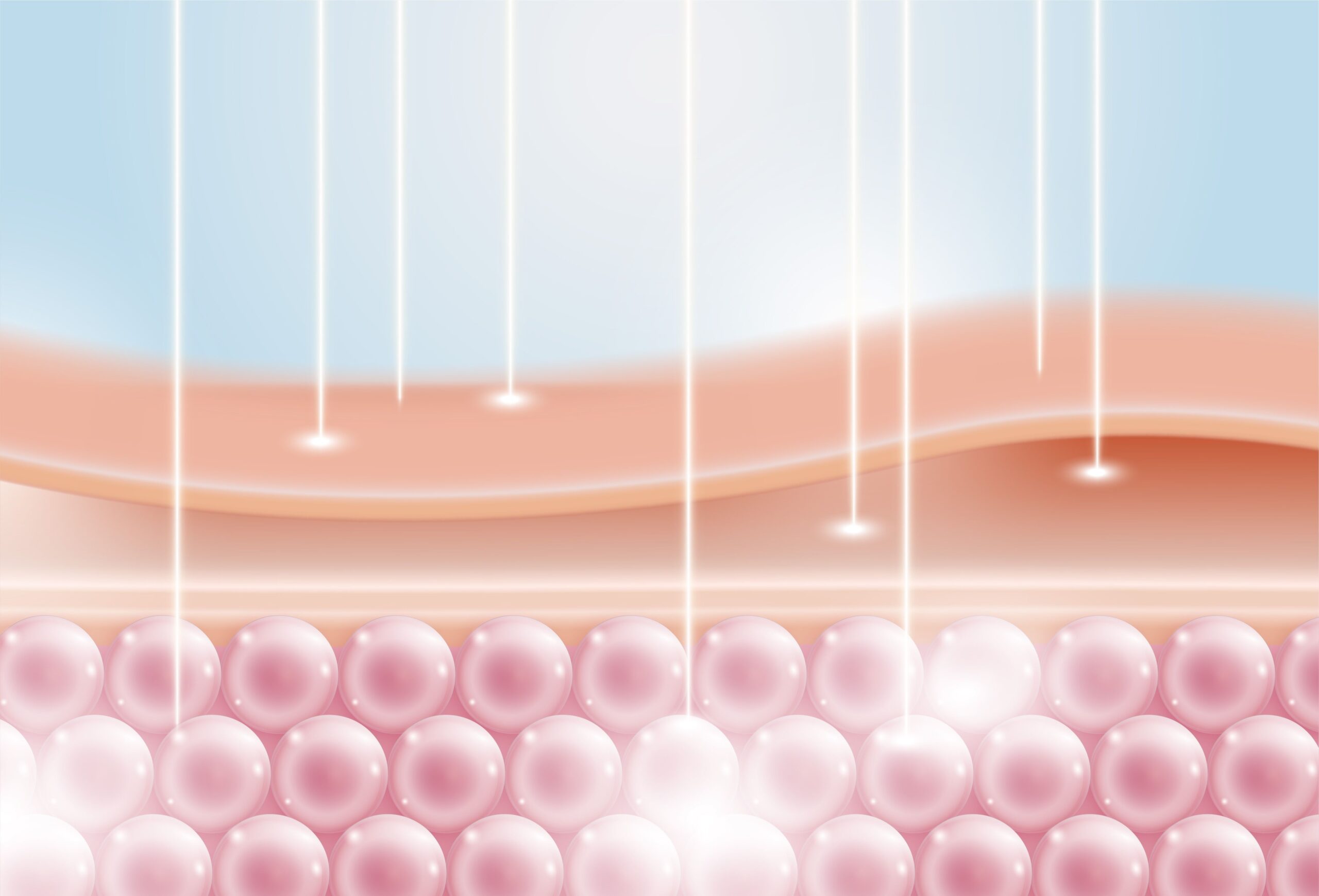 Rejuvenation Laser คืออะไร