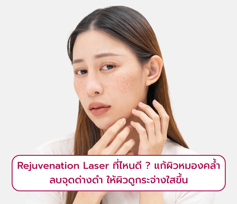 Rejuvenation Laser ที่ไหนดี