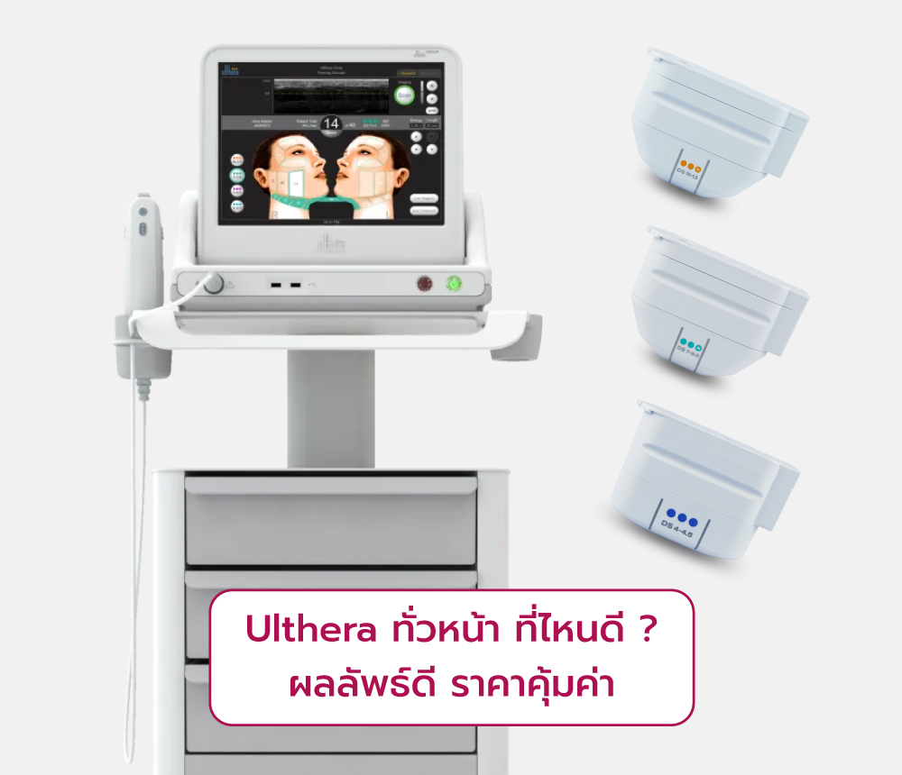 Ulthera-ทั่วหน้าที่ไหนดี