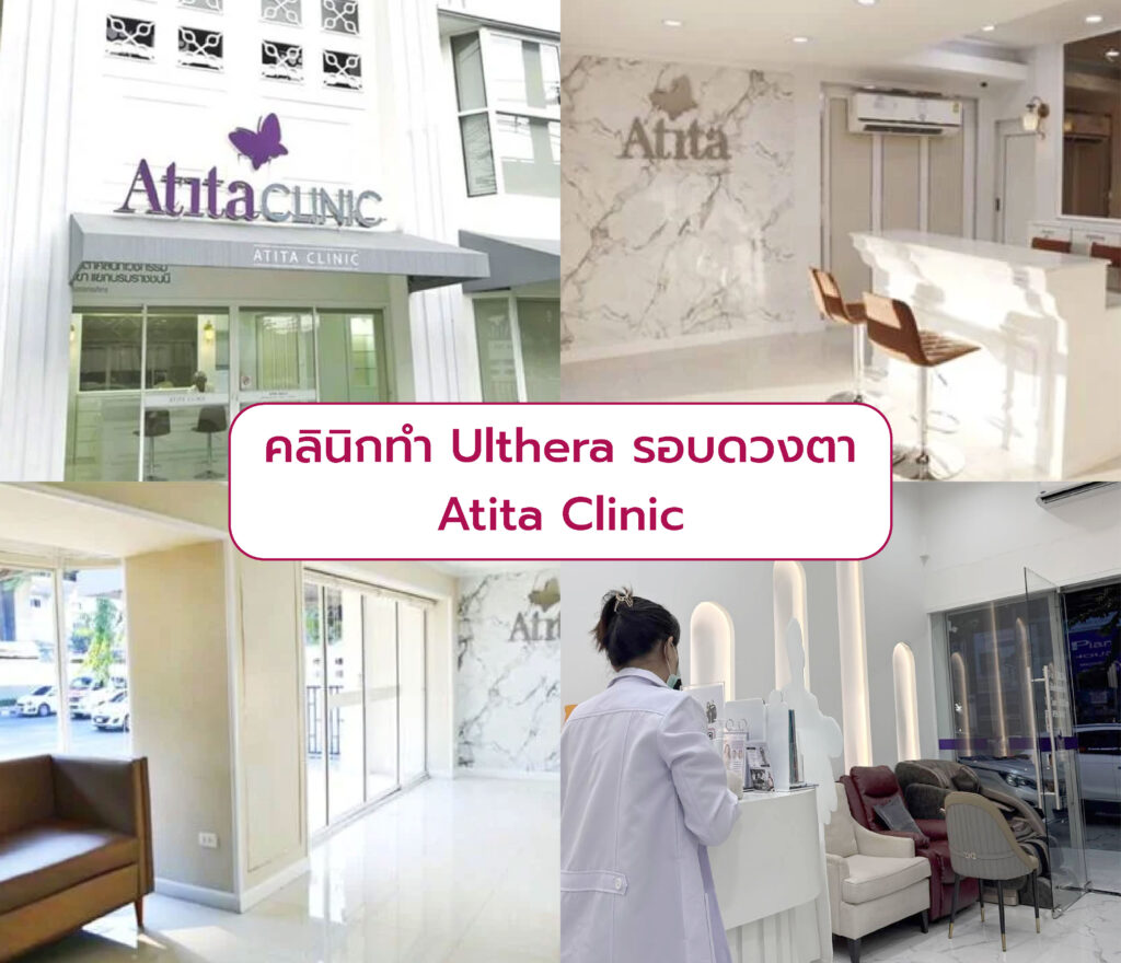 Ulthera รอบดวงตา ที่ไหนดี Atita Clinic