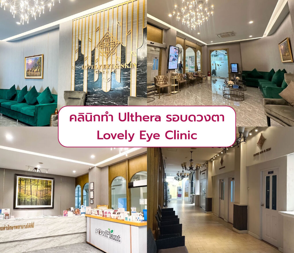 Ulthera รอบดวงตา ที่ไหนดี Lovely Eye Clinic