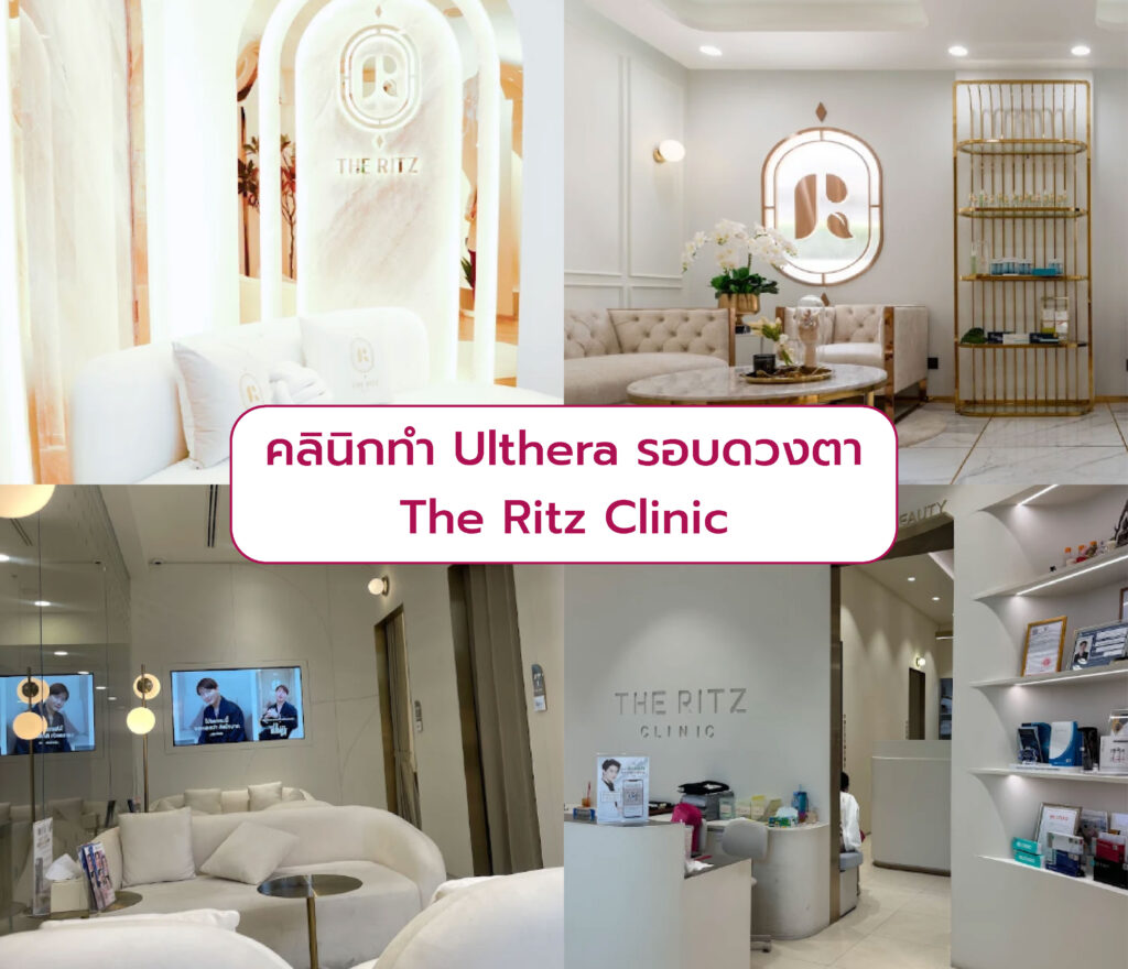 Ulthera รอบดวงตา ที่ไหนดี The Ritz Clinic