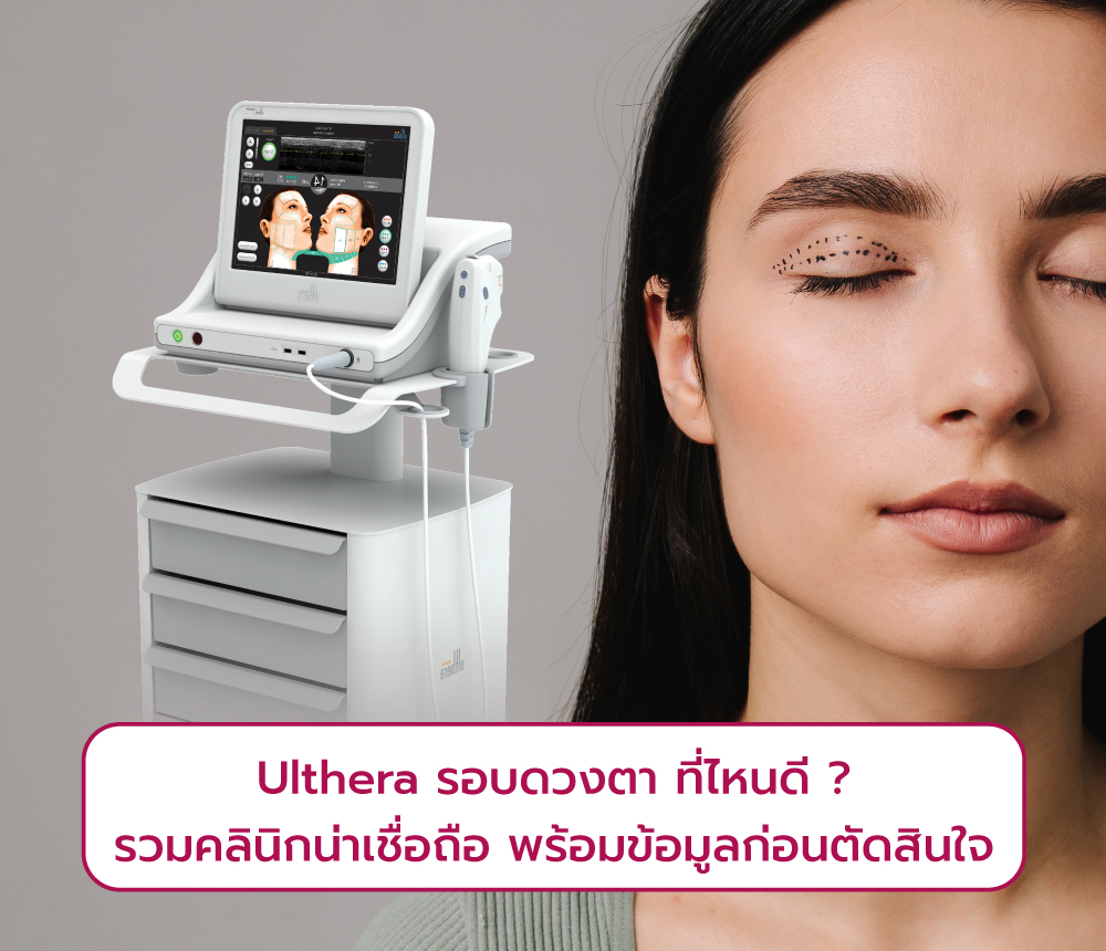 Ulthera รอบดวงตา ที่ไหนดี