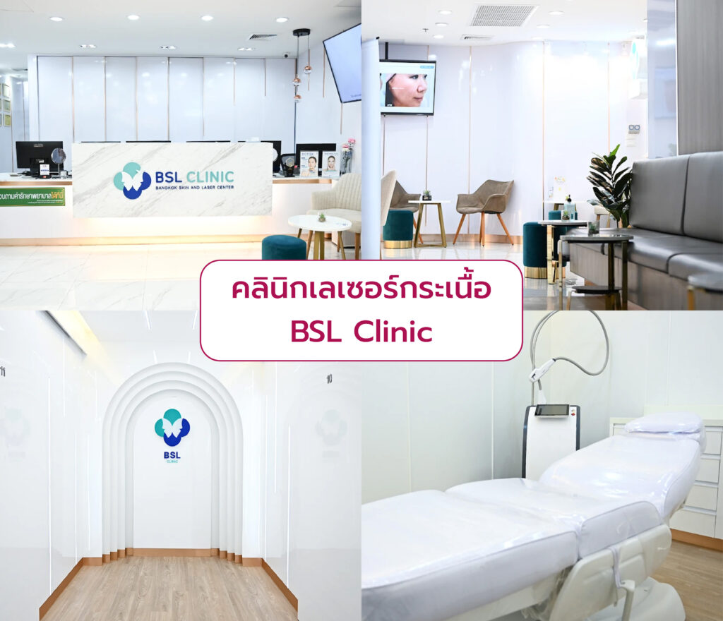 เลเซอร์กระเนื้อ ที่ไหนดี BSL Clinic