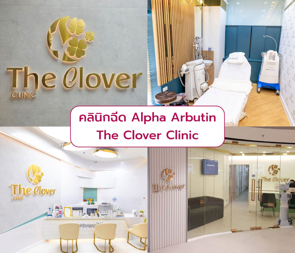 ฉีด Alpha Arbutin ที่ไหนดีง The Clover Clinic