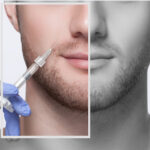 โบท็อกผู้ชาย ที่ไหนดี 370x2777