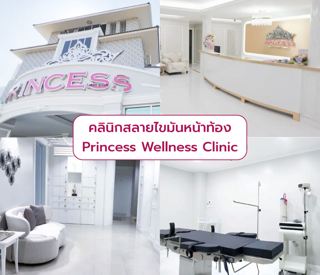 คลินิกกำจัดไขมันหน้าท้อง Princess Wellness Clinic