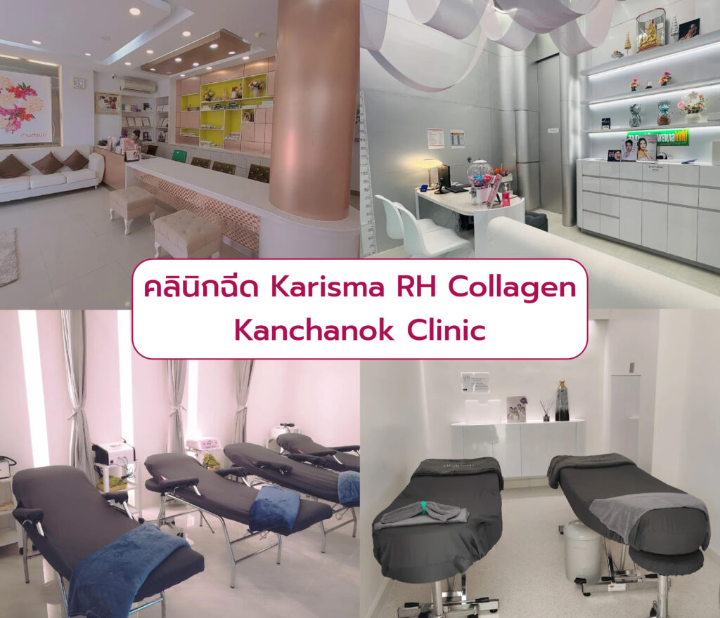 คลินิกฉีด Karisma RH Collagen Kanchanok Clinic