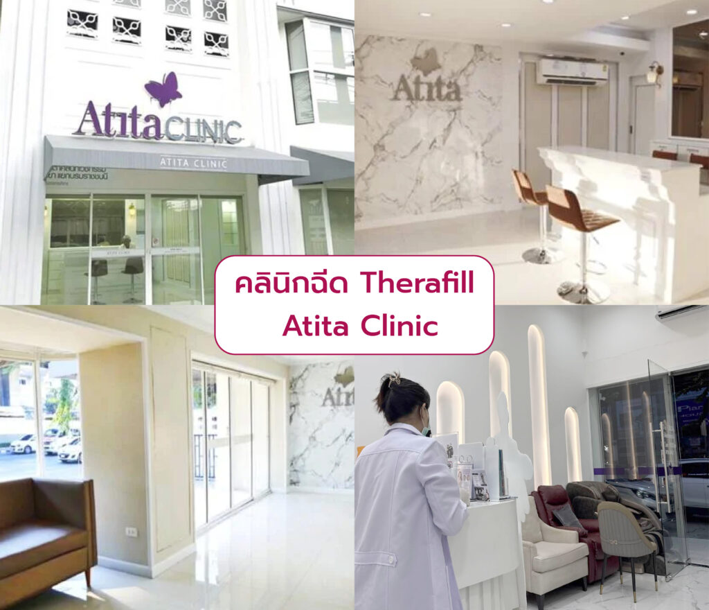 คลินิกฉีด Therafill Atita Clinic